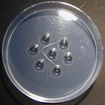 Three step purification of C1q by DNA precipitation ion