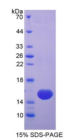 Automated Protocol for Sigma-Aldrich