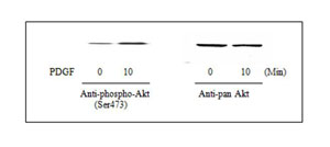 Protein/Western Blotting Protocols