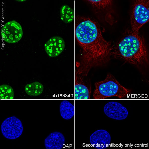 Recombinant Human LONP1 Protein Novus Biologicals