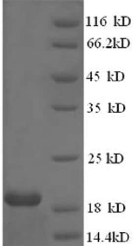 Recombinant Pt n Expression 2005 Messenger Rna