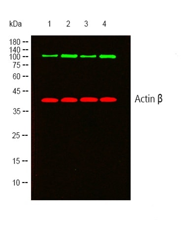 Detection of Histone Proteins Using Western Blot Protocol