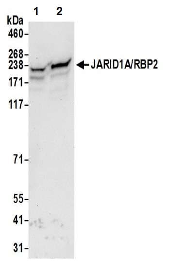 Western Analysis of Histone Modifications (Aspergillus