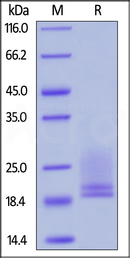 Expression and purification of recombinant proteins