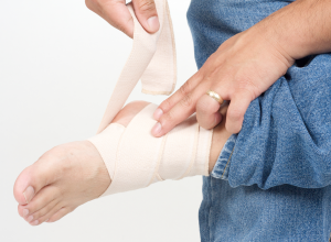 RICE or MEAT Protocol for Acute Ligament Sprain Treatment